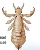 Head louse