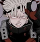 Albino Bakugo