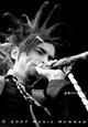 02-Jimmy Urine