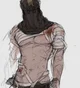 wounds