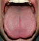 Tongue