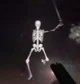 Normal Skeleton