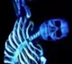 Blue Skeleton