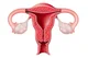 Uterus 