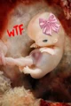 Unborn fetus TG