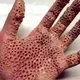 Trypophobia virus