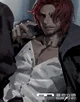 Shanks