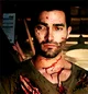 Hurt Derek Hale 