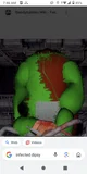 Infected dipsy