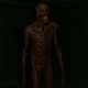 Skinless Corpse