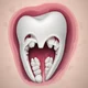 Wisdom Tooth